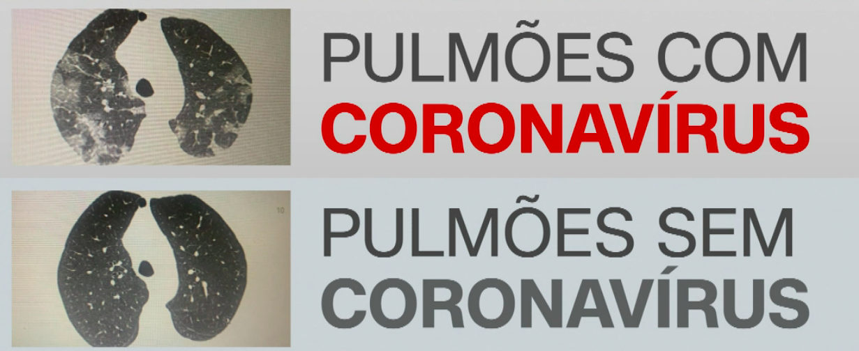 1614_53822A5C581B79A1